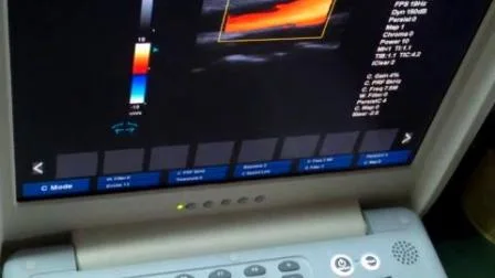 Système portatif promotionnel d'ultrason de Doppler de couleur de l'affichage 2D d'affichage à cristaux liquides de 15 pouces portatif de Sunbright