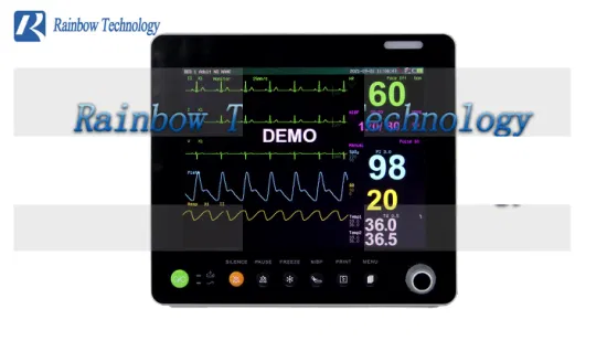 Moniteur patient vétérinaire multi-paramètres portable, moniteur de signes vitaux pour chien, chat, diagnostic vétérinaire pour chien/cochon/chat/cheval/autres animaux