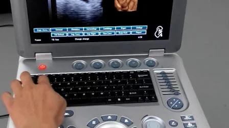 Machine d'écho à ultrasons entièrement numérique 3D pour diagnostic de grossesse