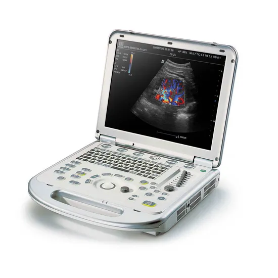 Système d'imagerie diagnostique ultrasonique portable Mindray M7 Premium, système d'échographie Doppler couleur