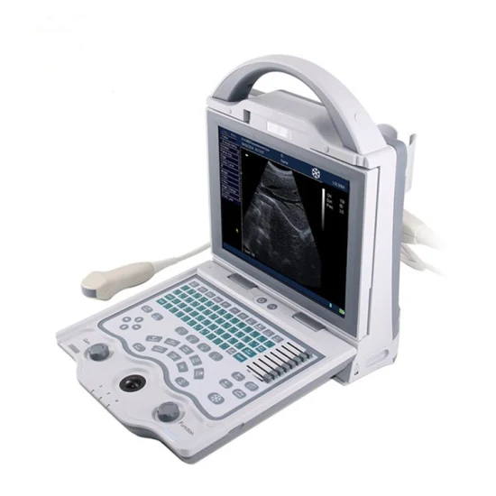 Système de diagnostic portatif d'ultrason Doppler couleur de prix d'ultrason Doppler